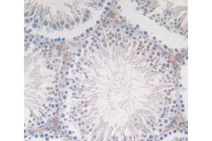 Detection of CT in Rat Testis Tissue using Monoclonal Antibody to Calcitonin (CT) (Calcitonin 抗体  (AA 85-116))