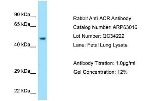 Western Blotting (WB) image for anti-Acrosin (ACR) (C-Term) antibody (ABIN2789340) (Acrosin 抗体  (C-Term))