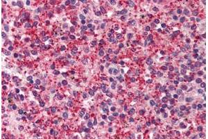 Human Spleen (formalin-fixed, paraffin-embedded) stained with KIAA1303 antibody ABIN214505 at 2. (Raptor 抗体)