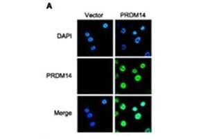 IFanalysis of PRDM14 in breast cancer cells. (PRDM14 抗体  (N-Term))