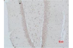 Immunohistochemistry (IHC) analysis of paraffin-embedded Rat Brain Tissue using NMBR Polyclonal Antibody. (NMBR 抗体)