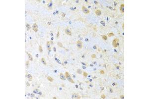 Immunohistochemistry of paraffin-embedded mouse brain using MLN antibody at dilution of 1:100 (40x lens). (Motilin 抗体)