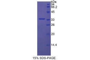 SDS-PAGE analysis of Human Semaphorin 7A Protein. (SEMA7A 蛋白)