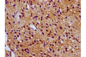 IHC image of ABIN7171107 diluted at 1:300 and staining in paraffin-embedded human glioma performed on a Leica BondTM system. (SV2C 抗体  (AA 459-524))