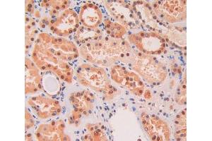 IHC-P analysis of kidney tissue, with DAB staining. (KIF5A 抗体  (AA 473-605))