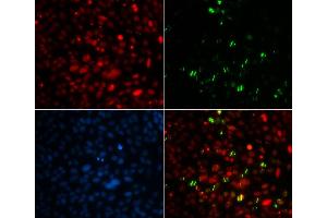 Immunofluorescence (IF) image for anti-Centrin, EF-Hand Protein, 2 (CETN2) antibody (ABIN1876585) (CETN2 抗体)