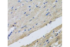 Immunohistochemistry of paraffin-embedded Rat heart using FECH Polyclonal Antibody at dilution of 1:100 (40x lens). (FECH 抗体)