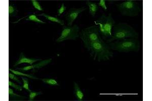 Immunofluorescence of purified MaxPab antibody to APOBEC2 on HeLa cell. (APOBEC2 抗体  (AA 1-224))