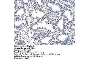 Rabbit Anti-CARS Antibody  Paraffin Embedded Tissue: Human Lung Cellular Data: Alveolar cells Antibody Concentration: 4. (CARS 抗体  (C-Term))