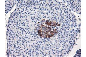 Immunohistochemical staining of paraffin-embedded Human pancreas tissue using anti-ACSS2 mouse monoclonal antibody. (ACSS2 抗体)