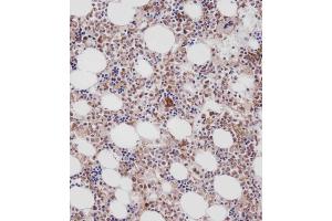 Immunohistochemical analysis of C on paraffin-embedded Human marrow tissue. (Cathepsin K 抗体  (AA 207-237))