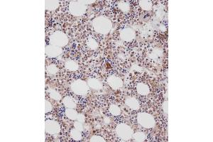 Immunohistochemical analysis of C on paraffin-embedded Human marrow tissue.