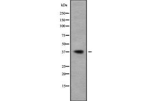 Western blot analysis of BCL2L14 using A549 whole cell lysates (BCL2L14 抗体  (N-Term))