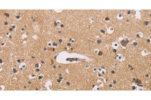 Immunohistochemistry (Paraffin-embedded Sections) (IHC (p)) image for anti-ATPase, Ca++ Transporting, Type 2C, Member 1 (ATP2C1) antibody (ABIN7236338)