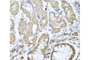 Immunohistochemistry of paraffin-embedded Human stomach using NRG4 Polyclonal Antibody at dilution of 1:100 (40x lens). (Neuregulin 4 抗体)