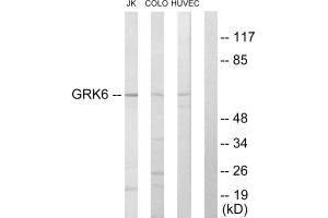 Western blot analysis of extracts from Jurkat cells, COLO205 cells and HUVEC cells, using GRK6 antibody. (GRK6 抗体  (N-Term))