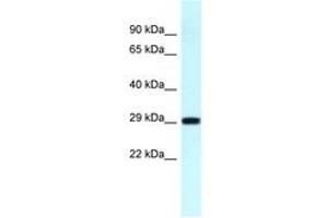 Image no. 1 for anti-Ribosomal Protein S4, Y-Linked 1 (RPS4Y1) (C-Term) antibody (ABIN6747705) (RPS4Y1 抗体  (C-Term))