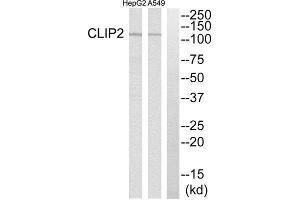 Western Blotting (WB) image for anti-CAP-GLY Domain Containing Linker Protein 2 (CLIP2) (C-Term) antibody (ABIN1850986) (CLIP2 抗体  (C-Term))