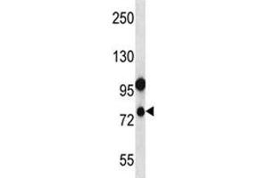 NLRP10 antibody western blot analysis in human placenta tissue lysate. (NLRP10 抗体  (AA 466-494))