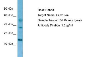 Western Blotting (WB) image for anti-Family with Sequence Similarity 19 (Chemokine (C-C Motif)-Like), Member A4 (FAM19A4) (N-Term) antibody (ABIN2781904)