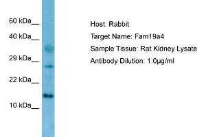 WB Suggested Anti-Fam19a4 Antibody   Titration: 1. (FAM19A4 抗体  (N-Term))