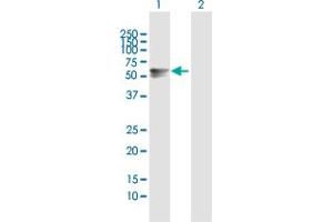 Western Blot analysis of ARSA expression in transfected 293T cell line by ARSA MaxPab polyclonal antibody. (Arylsulfatase A 抗体  (AA 1-507))