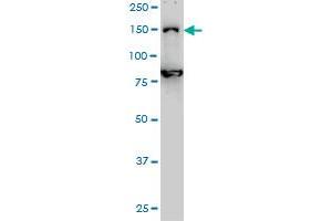 DHX8 monoclonal antibody (M01), clone 1E10 Western Blot analysis of DHX8 expression in Hela S3 NE . (DHX8 抗体  (AA 301-400))