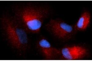 Immunofluorescence (IF) image for anti-Complexin 1 (CPLX1) (AA 1-134) antibody (PE) (ABIN5565320) (Complexin 1 抗体  (AA 1-134) (PE))