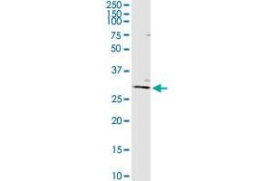 AGPAT2 MaxPab rabbit polyclonal antibody. (AGPAT2 抗体  (AA 1-278))