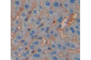 Immunohistochemistry (IHC) image for anti-Protocadherin 1 (PCDH1) (AA 246-517) antibody (ABIN5014229)