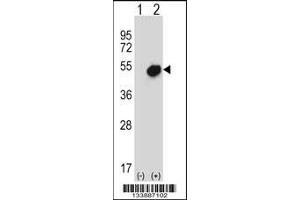 Western blot analysis of NR0B1 using rabbit polyclonal NR0B1 Antibody using 293 cell lysates (2 ug/lane) either nontransfected (Lane 1) or transiently transfected (Lane 2) with the NR0B1 gene. (NR0B1 抗体  (AA 304-333))