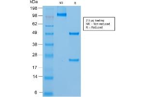 SDS-PAGE Analysis of Purified MUC18 Mouse Recombinant Monoclonal Antibody (rMUC18/1130). (Recombinant MCAM 抗体)