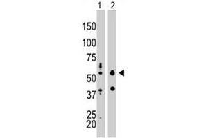 The EIF2AK2 polyclonal antibody  is used in Western blot to detect EIF2AK2 in mouse liver tissue lysate (Lane 1) and HepG2 cell lysate (Lane 2) . (EIF2AK2 抗体  (N-Term))