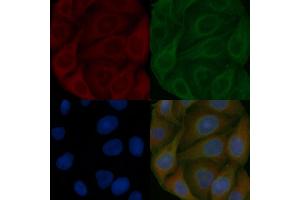 TFG Mouse Monoclonal Antibody staining Hela cells by IF/ICC. (TFG 抗体)
