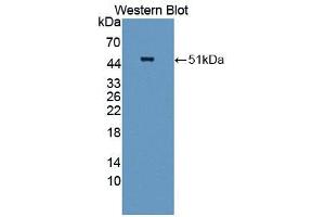 Western blot analysis of the recombinant protein. (KPNB1 抗体  (AA 21-441))