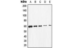 Western blot analysis of c-SRC expression in K562 (A), HeLa (B), MCF7 (C), HepG2 (D), mouse primary astrocytes (E) whole cell lysates. (Src 抗体  (C-Term))