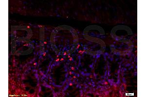 Formalin-fixed and paraffin embedded mouse kidney tissue labeled with Rabbit Anti-L-Selectin/CD62L Polyclonal Antibody (ABIN736716), Unconjugated 1:200 followed by conjugation to the secondary antibody and DAB staining (L-Selectin 抗体  (AA 301-372))