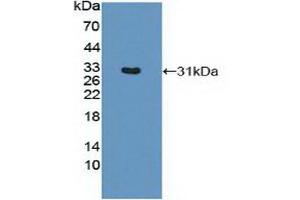 Western blot analysis of recombinant Mouse MHCDRb1. (HLA-DRB1 抗体  (AA 27-264))