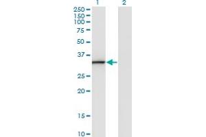 Western Blot analysis of ANXA3 expression in transfected 293T cell line by ANXA3 monoclonal antibody (M07), clone 1E2. (Annexin A3 抗体  (AA 1-323))