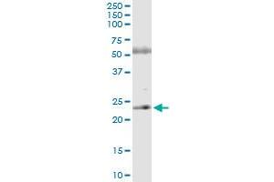 Immunoprecipitation of ASPH transfected lysate using anti-ASPH MaxPab rabbit polyclonal antibody and Protein A Magnetic Bead , and immunoblotted with ASPH purified MaxPab mouse polyclonal antibody (B02P) . (Aspartate beta Hydroxylase 抗体  (AA 1-210))