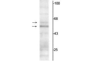 Western blot of rat hippocampal lysate showing specific immunolabeling of the ~50 kDa TR-α1 and the ~58 kDa TR-α2 protein. (THRA 抗体  (N-Term))