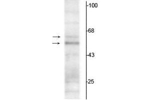 Western Blotting (WB) image for anti-Thyroid Hormone Receptor, alpha (THRA) (N-Term) antibody (ABIN361382)