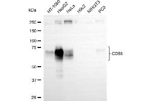 Western blotting analysis using CD55 antibody (ABIN7798142). (Recombinant CD55 抗体)