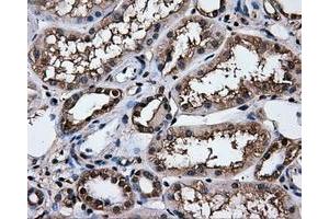 Immunohistochemical staining of paraffin-embedded Kidney tissue using anti-HSPA1Amouse monoclonal antibody. (HSP70 1A 抗体)