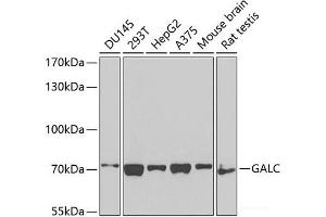 Western blot analysis of extracts of various cell lines using GALC Polyclonal Antibody at dilution of 1:1000. (GALC 抗体)