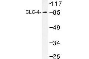 Image no. 1 for anti-Chloride Channel 4 (CLCN4) antibody (ABIN317826) (CLCN4 抗体)