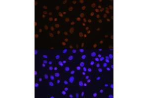 Immunofluorescence analysis of NIH/3T3 cells using HD antibody (ABIN7267707) at dilution of 1:100. (HDAC1 抗体)