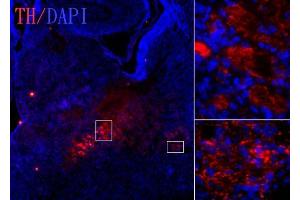IHC-Fr Image Tyrosine hydroxylase antibody [N1C1] detects tyrosine hydroxylase protein on embryonic mouse brain by immunohistochemical analysis. (Tyrosine Hydroxylase 抗体)