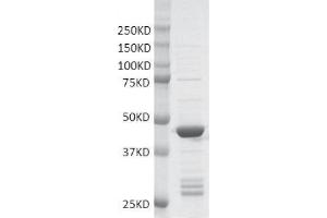 Recombinant MLL2-SET protein gel.