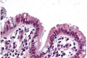 Immunohistochemistry (Formalin-fixed Paraffin-embedded Sections) (IHC (fp)) image for anti-SWI/SNF Related, Matrix Associated, Actin Dependent Regulator of Chromatin, Subfamily B, Member 1 (SMARCB1) (AA 81-181) antibody (ABIN790482)